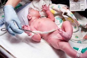 Cord Blood Donation; An Option Post-Labor