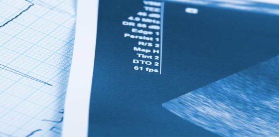 Pränataldiagnostik und ihre Bedeutung für eine gesunde Schwangerschaft 1