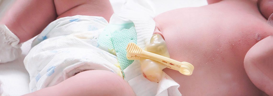 The Benefits of Delayed Cord Clamping  1
