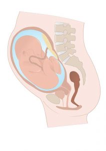 Understanding Breech Babies 1