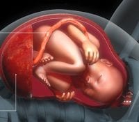 A Complete Guide to Placenta Accreta