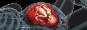 A Complete Guide to Placenta Accreta