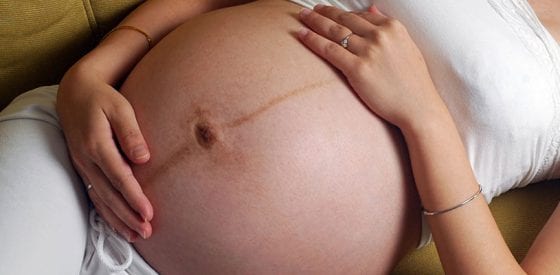 Understanding Linea Nigra; A Pregnant Belly’s Dark Line 