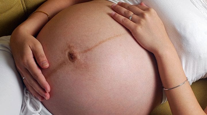 Understanding Linea Nigra; A Pregnant Belly’s Dark Line 