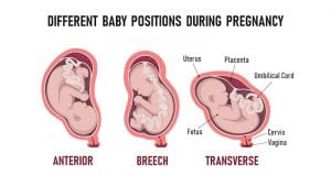 How to Naturally Reposition Baby for Birth and Why Position is so Important