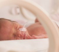 Causes, Concerns, and Degrees of Prematurity 1