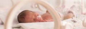 Causes, Concerns, and Degrees of Prematurity 1