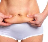 Tummy Tuck’s After Pregnancy - All You Need to Know