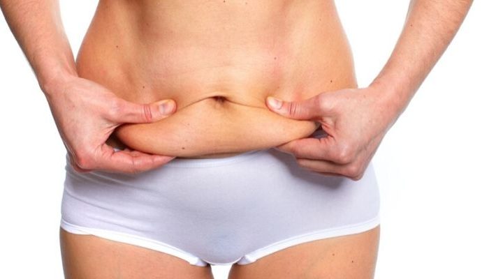 Tummy Tuck’s After Pregnancy - All You Need to Know