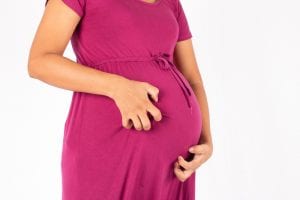 Understanding Itching During Pregnancy