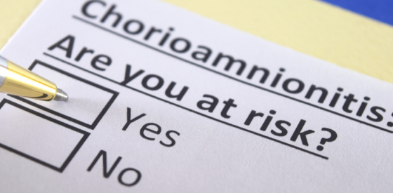 Chorioamnionitis: Understanding the Intra-Amniotic Infection 1