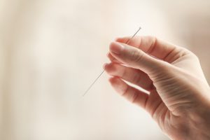 Acupuncture During Pregnancy: Is It Safe? 2