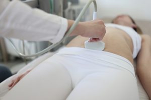 A Complete Guide to Amniocentesis 1