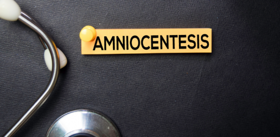 A Complete Guide to Amniocentesis