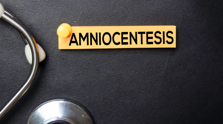 A Complete Guide to Amniocentesis