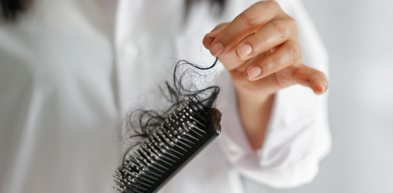 Everything You Should Know About Postpartum Hair Loss 1