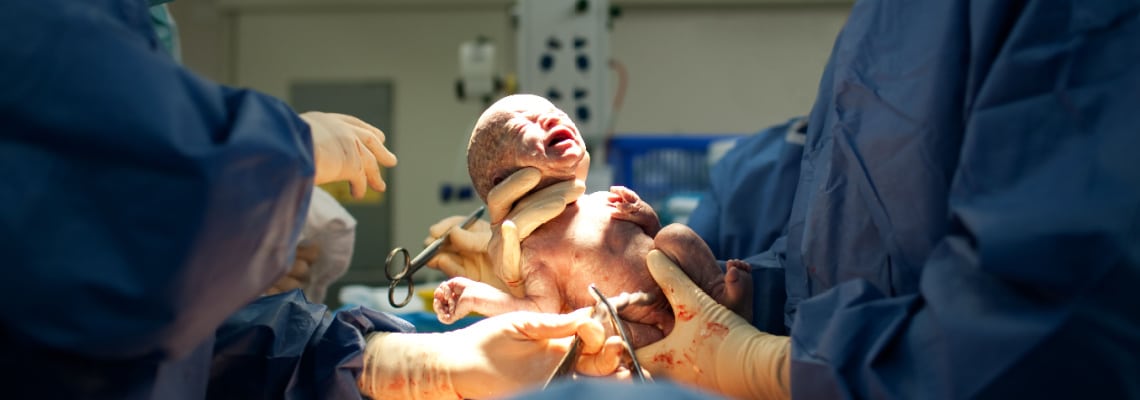 Do Babies Born by Cesarean Section Get Fewer Important Gut Bacteria?