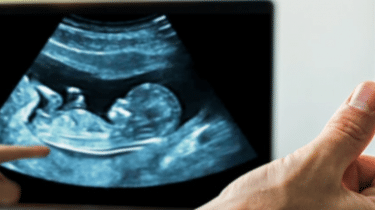 How Nicotine Harms the Embryo