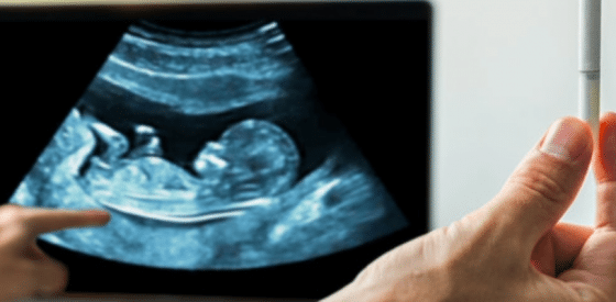 How Nicotine Harms the Embryo