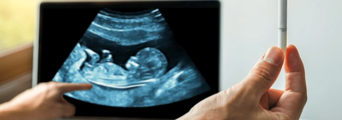 How Nicotine Harms the Embryo